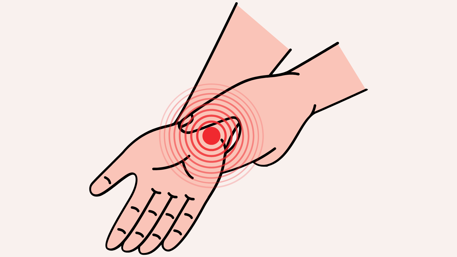 一夜明けて。手首はやっぱり痛い